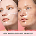 Rael Collagen PDRN Hydrogel Face Masks – Deep Hydration with Salmon PDRN, Collagen, Peptide, and Hyaluronic Acid, Anti-Slip, Korean Skin Care (4 Count)