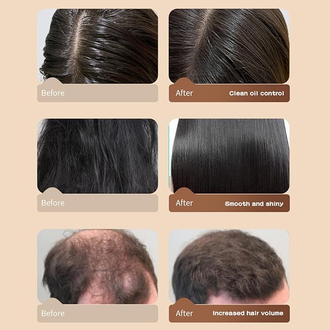 Silvercell Castor Oil Conditioner Hair Growth Conditioner Moisturizing Oil Control, Thickening Hair Conditioner for Damaged Dry Hair, 16.91 fl.oz