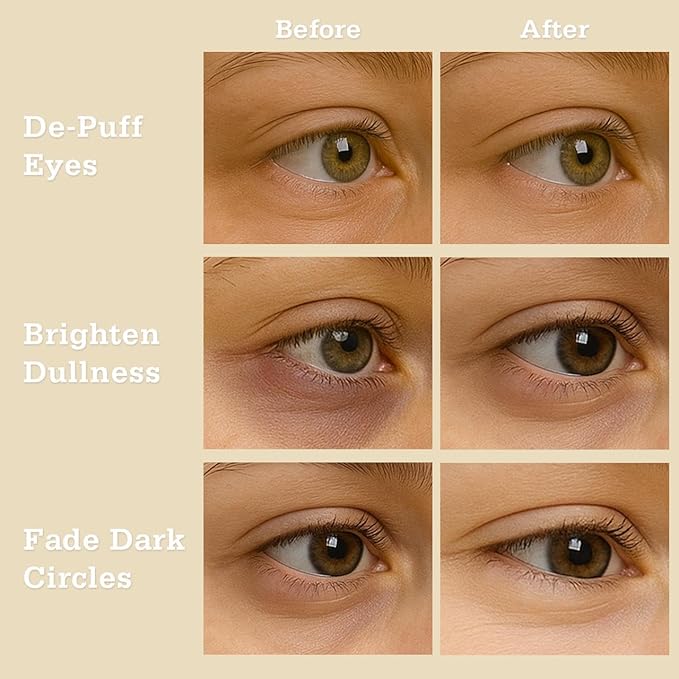 Oat Hydrogel Under Eye Patches for Sensitive Skin 28 Pairs 5 Minute Soothing Hydrating Eye Pads with Oat and Honey Gentle Eye Care Mask for Dry Tired Eyes Ophthalmologist Tested