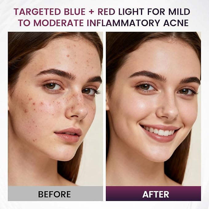 Red Light Therapy for Face – 8 Light Modes with 850nm Near-Infrared, 280 LED Face Mask Light Therapy for Skin Appearance, Fine Lines, Firming Support, FDA Cleared, Cordless Design