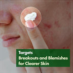 TOSOWOONG Madagascar Centella Cream, 706,580ppm Madagascar Centella Asiatica, Moisturizer, Rapid Soothing, Deep Hydration with Cica Complex, Skin Barrier Repair, Irritation Relief, 50ml / 1.69 fl. oz.