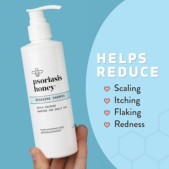 PSORIASIS HONEY Renewing Shampoo - Itchy & Dry Scalp Treatment - Psoriasis Shampoo With Argan Oil for Women & Men - Scalp Psoriasis Relief - Daily Hair Shampoo for Kids (8oz)