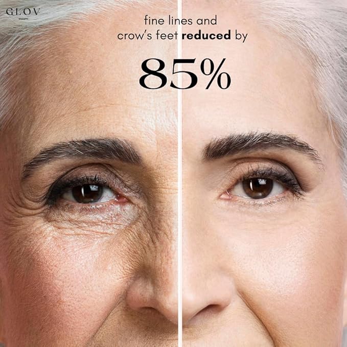 Glov Beauty Intense Rejuvenating Under Eye Gels - Hydrating Eye Mask w/Hyalronic Acid & Hydrolyzed Collagen - Under Eye Patches For Dark Circles - Minimize Puffiness & Wrinkle Reducer - 30 Pairs