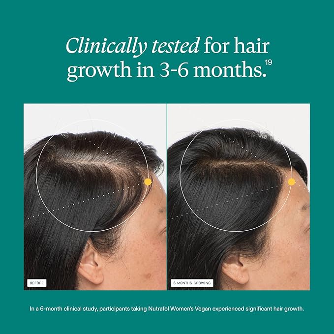 Nutrafol Women's Hair Growth Supplements, For Women 18-44 Years Old, Clinically Tested for Visibly Thicker, Stronger Hair, 100% Vegan Ingredients, Dermatologist Recommended - 1 Month Supply