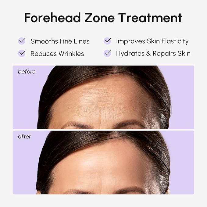 MAREE Forehead Wrinkle Patches – Collagen Wrinkle Patches with Retinol & Hyaluronic Acid for Face Lift – Fine Lines Deep Forehead Wrinkles Treatment Remover – Face Tape for Wrinkles Between Eyebrows