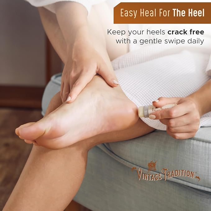 Vintage Tradition Moisturizing Beef Tallow Lip Balm – Unscented Tube Lip Moisturizer for Sensitive Skin Hydrates & Soothes Dry Lips – Grass-Fed Tallow Balm for Skin Care, 0.5 Fl. Oz.