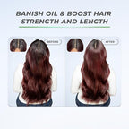 XMONDO Hair BOOST X Dry Shampoo, Zero Residue, Formulated with Saw Palmetto to Promote Scalp Care, Clinically Tested, Dermatologist Tested, Talc-free, Benzene-free, Free of aluminum starch, 5 oz