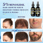 5% Minoxidil for Women with Biotin Hair Growth Serum, Minoxidil for Men Spray with Rosemary for Thicker Fuller Hair