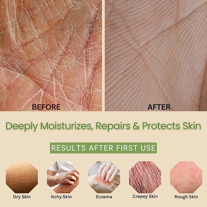 Natural Escapes Lavender & Lemongrass Body Lotion 2-Pack – Hydrating Hand & Body Moisturizer for Dry Sensitive Skin – Vegan Plant-Based Lotion with Ceramides, Aloe Vera & Vitamins – 8oz Each