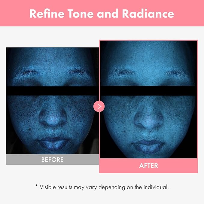 TOSOWOONG PDRN Hyaluron Face Cream, 5,000ppm Salmon DNA, Niacinamide, Hyaluronic Acid and Panthenol Moisturizer for Hydrating & Firming, Uneven Skin Tone Care, Korean Skincare, 50ml / 1.69 fl. oz.