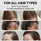 lilyeve GROWTURN Hair Growth Serum with Built-in Brush, Heartleaf-Derived Exosomes to Revitalize Hair, Hair Thickening, Hair Growth Accelerator - Korean Hair Care, 3.38 fl. oz. (Pack of 4)