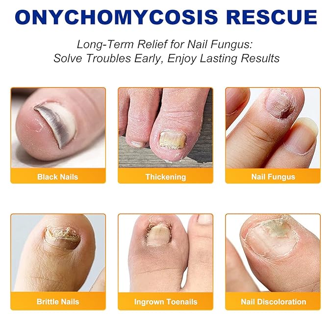 2Pack Toenail Treatment Extra Strength - 64 Pcs Nail Patches, 8-Hrs Overnight Nail Repair, Safe for Sensitive Skin, Easy to Apply