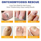 2Pack Toenail Treatment Extra Strength - 64 Pcs Nail Patches, 8-Hrs Overnight Nail Repair, Safe for Sensitive Skin, Easy to Apply