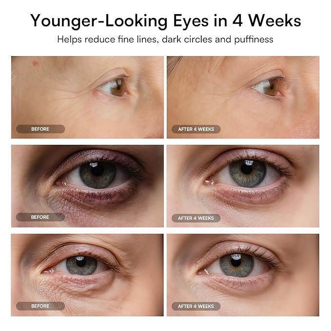 INIA Red Light Therapy Eye Mask for Under Eye Treatment & Rejuvenation - Skincare Device for Dark Circles, Wrinkles, Forehead Lines, Crow's Feet