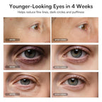 INIA Red Light Therapy Eye Mask for Under Eye Treatment & Rejuvenation - Skincare Device for Dark Circles, Wrinkles, Forehead Lines, Crow's Feet