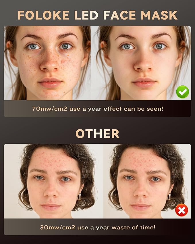 FOLOKE LED Light Therapy Mask Skin Care Mask, LED Red Light Therapy 630nm & 830nm Wavelength for Home Use, Body Beauty Machine for Care at Home (White)