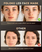 FOLOKE LED Light Therapy Mask Skin Care Mask, LED Red Light Therapy 630nm & 830nm Wavelength for Home Use, Body Beauty Machine for Care at Home (White)