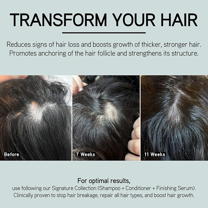 ILES FORMULA Scalp + Hair Rejuvenating Booster – Non-Greasy Hair Serum to Support Growth for Visibly Thicker, Stronger, Fuller Hair – Natural, Lightweight & Fast-Absorbing Scalp Serum with Procapil