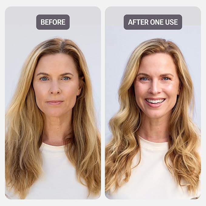 NULASTIN Vibrant Scalp Hair Conditioner - Volumizing Conditioner for Fine Hair - Supports the Appearance of Fuller, Healthy-Looking Strands at the Root - Color-Safe, Silicone Free & Vegan (10 Fl Oz)