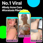 SOME BY MI AHA BHA PHA 30 Days Miracle Acne Clear Body Cleanser – 13.5oz, 400ml – Daily Exfoliating Tea Tree & Salicylic Acid Acne Body Wash – Deep Cleanses Sebum, Oil & Impurities – Korean Skin Care