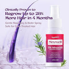 5% Minoxidil Spray for Women Hair Growth: RootStim Extra Strength Hair Regrowth Treatment with Biotin, Caffeine & Peptides for Thinning Hair, Fuller & Healthier Hair - 2 Fl Oz