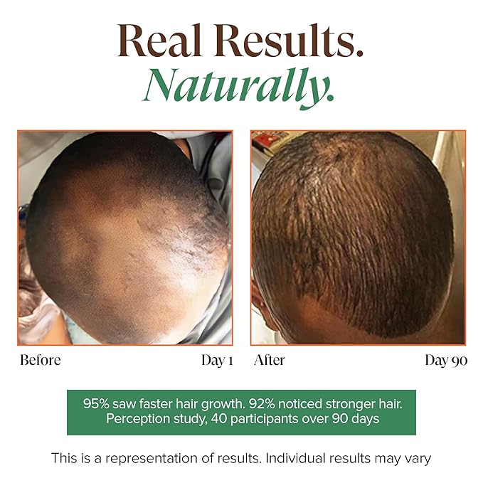 Kreyol Essence - Haitian Black Castor Oil for Skin and Hair, Glass Bottle - Cold Pressed Castor Oil, Fuller-Looking Hair, Hexane Free, Natural Humectant | 2 fl oz | Rosemary Peppermint