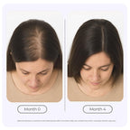 Rosemary Elixir – Daily Scalp Oil with 9 Essential Oils – Lightweight, Non-Greasy Formula for a Healthy-Looking Scalp – For Men & Women – 2oz