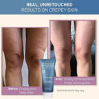 Crepe Firming Advanced Cream - European Hi-tech Skin care - Hyaluronic Acid in the 50-3000 kDa Molecular Spectrum - Tightening & Lifting Collagen Repair Treatment - Best for Body, Face and Neck 7.5 oz