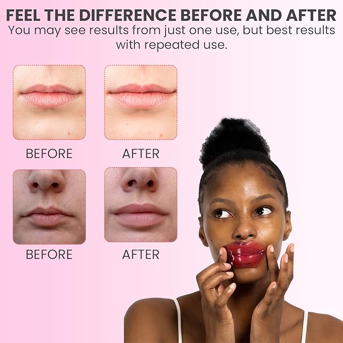 MISS SPA Lip Mask, Hydrate Boost Hydrogel Pink Lip Mask, Sooth Restore Lips, Lip Plumper, Moisturizing And Reducing Fine Lines, Anti-Aging Face Mask Skin Care, Nourishing Honey Lip Patches 4 Pack