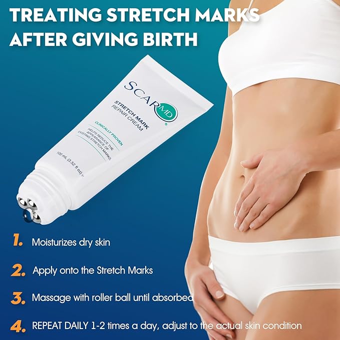 Stretch Mark Repair Cream is Formulated with Botanical Ingredients to Effectively Minimize Stretch Marks for a Smoother, More Even Skin Tone