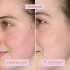 Tower 28 SOS Intensive Rescue Serum for Sensitive Skin, Hypochlorous Acid Skin Care, Helps Reduce Face Redness, Safe for All Skin Types, 2 FL Oz