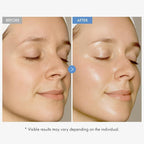 TOSOWOONG Hyaluronic Acid 9 Cream, Vitamin B5, Collagen, Niacinamide, Centella Asiatica Extract, Long-lasting Hydration, Daily Moisturizer Face Cream, Korean Skin Care, 50ml, 1.69 fl.oz.