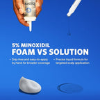 Men’s Rogaine Extra Strength 5% Minoxidil, Topical Solution for Thinning & Hair Loss, Clinically Proven FDA Approved Minoxidil for Men Treatment, Regrow Fuller Hair, 3 Month Supply, 3 Bottles