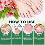 2PCS Nail Repair Gel, Nail Growth Repair Cream, New Multi-Purpose Nail Repair, Foot Care Cream for Moisturizing and Repairing Feet