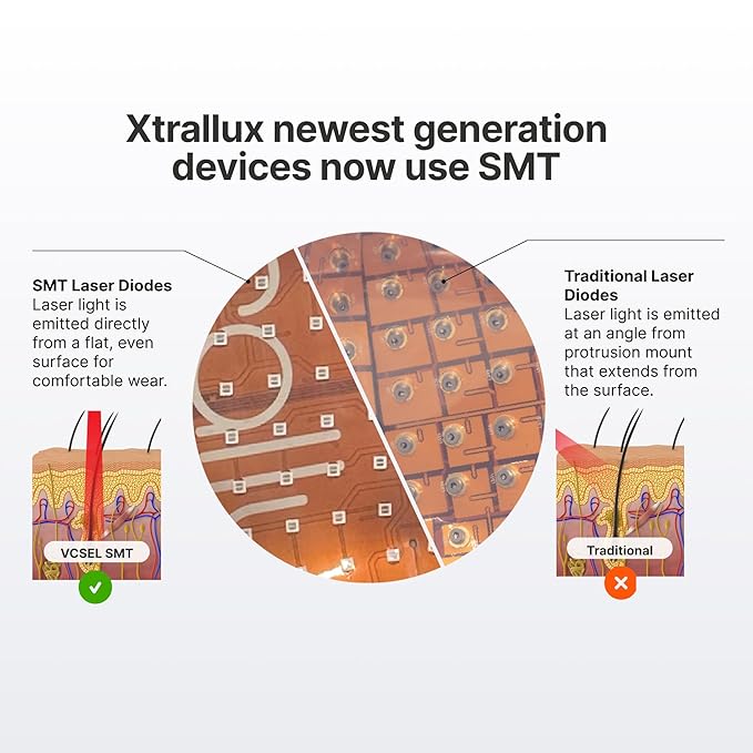 Hair Growth | Laser Hair Growth Products 276 Lasers 6 Minute Treatment FDA Cleared Drug-Free Comfortable Fit Lazer Hair Regrowth Hair Regrowth Lazer Treatment For Women