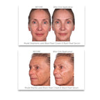 Black Pearl Deep Wrinkle Decrease Face and Neck Skin Moisturizing Duo - Facial Cream 1.7 oz and Treatment Serum for Face 1 oz - Hydrate, Brightening, Long Term Repair