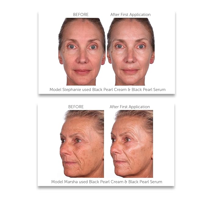 Black Pearl Deep Wrinkle Decrease Face and Neck Skin Moisturizing Duo - Facial Cream 1.7 oz and Treatment Serum for Face 1 oz - Hydrate, Brightening, Long Term Repair