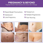 Stretch Mark Cream for Pregnant Women: Stretch Mark Treatment for Pregnancy - Belly Butter For Pregnant Women - Massage Lotion To Prevent And Repair Maternity Stretch Marks Scar - 4 Oz