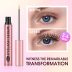 Lash Serum for Eyelash Growth: Premium Eyelash Growth Serum with Advanced Formula to Boost Longer Fuller and Thicker Lashes and Eyebrows - Gentle & Vegan for Sensitive Eyes (5 mL)