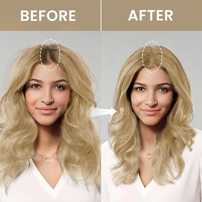 VOLLUCK Root Touch up Powder, Instant Hairline Powder for Thinning Areas and Gray Hair Coverage, Natural and Non-greasy Root Cover up for Women and Men (Medium Blonde, 0.14 Ounce)