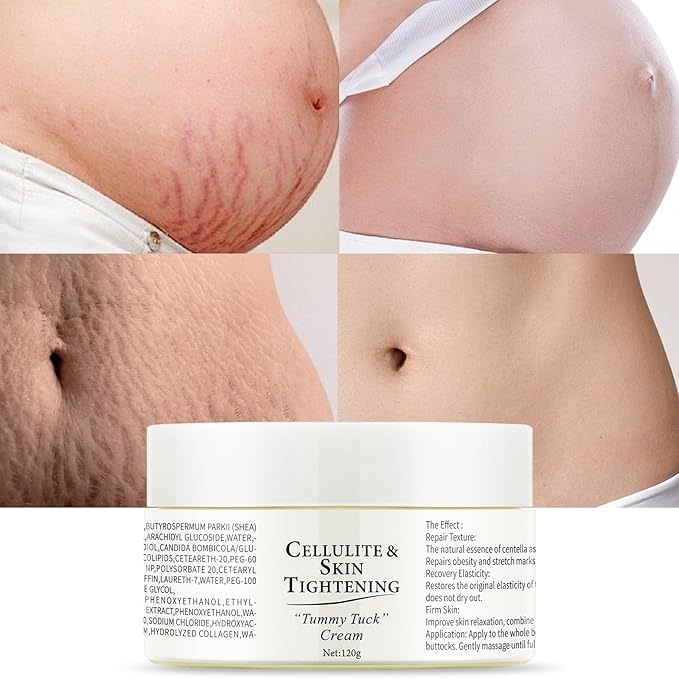 Stretch Marks Removal Cream for Pregnancy Massages Body & Reduces Scar Appearance,Gentle Stretch Marks Eradication Body Skincare Firming (120g/4.23oz)