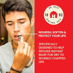 Dr. Hess Original Udder Stick SPF Lip Balm, Soothing Moisturizer Sun Screen Balm for Dry Lips with Jojoba, Beeswax & Shea Butter, Total Lip Care, Hydration & Repair, Coconut-Lime Flavor, 4 Pack