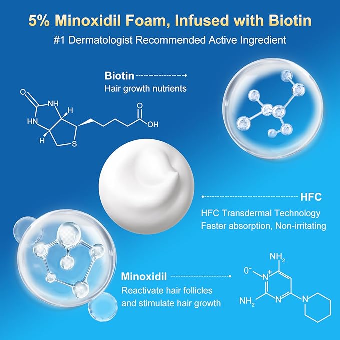 5% minoxidil foam for men-5pack， Infused with Biotin, Hair Growth Treatment, Supports Thicker and Fuller Hair & Beard (10.5oz, 5 Month Supply)