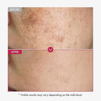 TOSOWOONG Niacinamide 10% + Tranexamic Acid 4% Serum, Arbutin 2%, Hyaluronic Acid, TXA Facial Serum, Glass Skin, Clarifying, Radiant Complexion with Natural Color, Korean Skin care, 33ml, 1.11 fl.oz.