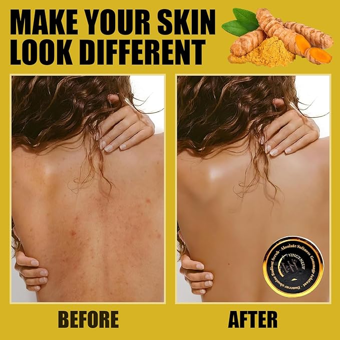 (29) Exfoliating Turmeric Body Scrub – Sea Salt, Jojoba & Almond Oil | Daily Body Exfoliator for Smooth, Radiant-Looking Skin | Gentle, Hydrating Scrub for All Skin Types (280ml)