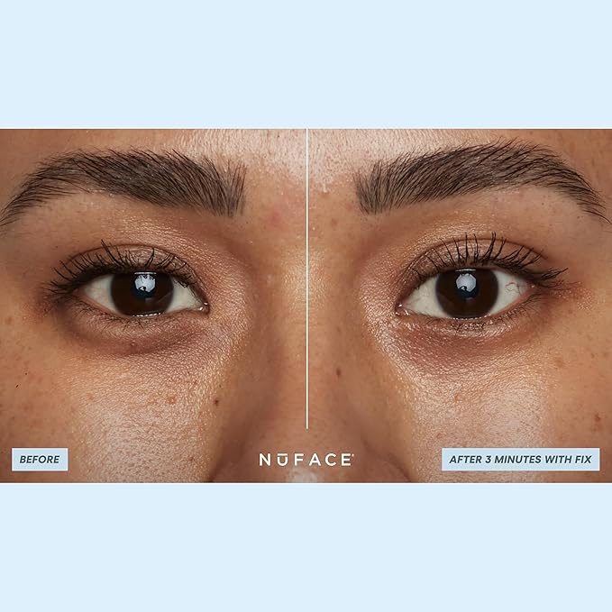 NuFACE IonPlex Hydra-Gel Power Under Eye Patches - Gel Under Eye Mask for Puffy Eyes & Dark Circles - Cooling Wrinkle Patches & Hydrating Treatment Pads to Energize, Brighten & Tighten (60 Count)