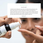 Malassezia Moisturizer, Soothe and Relieve, Safe for Folliculitis and Seborrheic Dermatitis, 2 fl oz