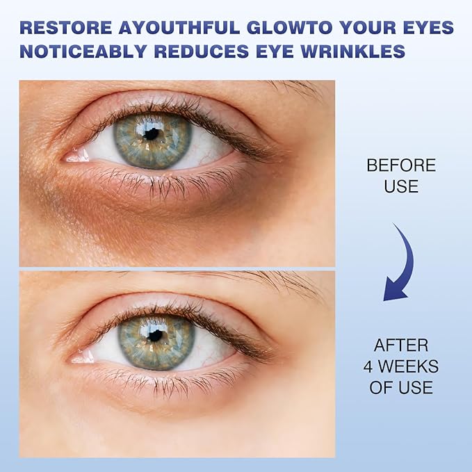 Caffeine Eye Cream, Under Eye Cream for Dark Circles and Puffiness, 5 in 1 with Retinol Niacinamide Hyaluronic Acid& Peptides - Eye Cream Anti Aging for Reduce Wrinkles, Puffiness and Bags Under Eyes