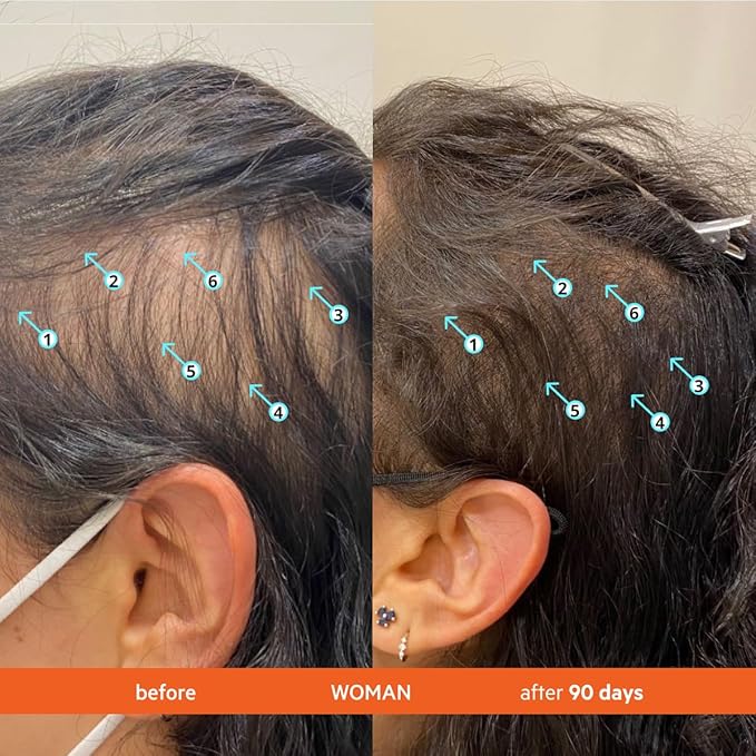 DS Labs Revita Shampoo & Revita Tablets Kit, 205mL & 30 Tablets – Scalp First Cleanse & Daily Supplement for Fuller Looking, Thicker Looking Hair, Sulfate & Silicone Free, for Men & Women