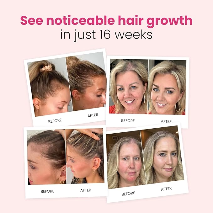 Trybello Hair Growth Shampoo | Natural Hair Thickening & Scalp Detox | Sulfate Free, Vegan, Anti-Hair Fall Formula | Caffeine, Aloe Vera, Turmeric, and Urucum Extract | For Any Hair Type